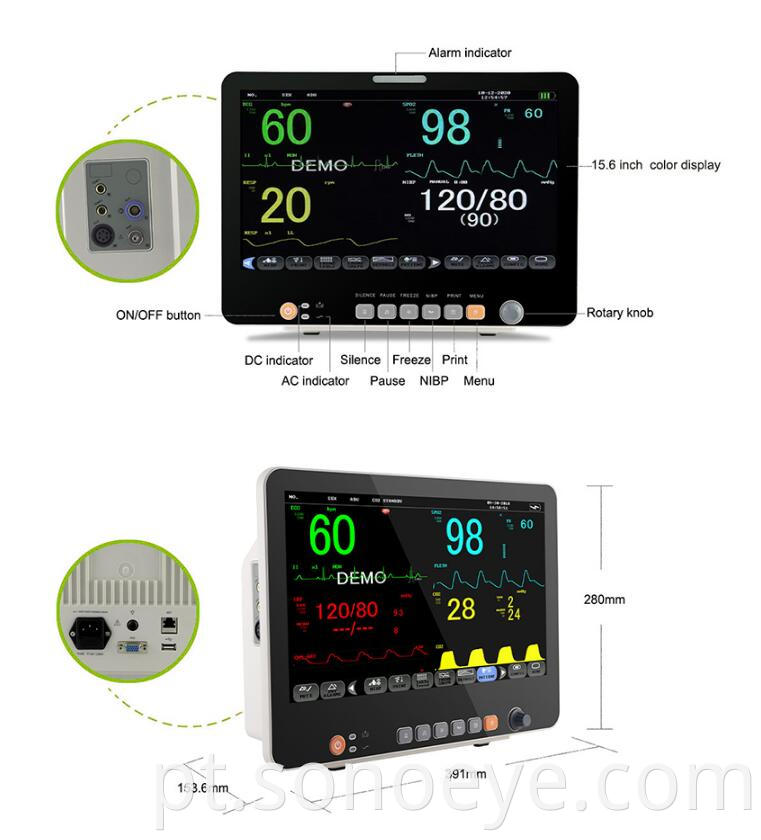 15 inch Multi-parameter monitor